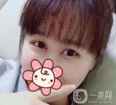 上海華美楊亞益做眼睛多少錢？?jī)r(jià)格表及案例詳情