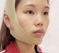 上海時光醫(yī)院何晉龍磨骨怎么樣？價格表及術(shù)后果分享