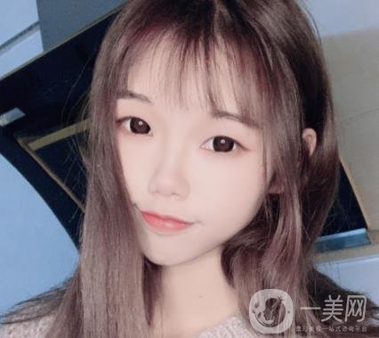 上海時(shí)光醫(yī)院何晉龍磨骨怎么樣？?jī)r(jià)格表及術(shù)后*果分享