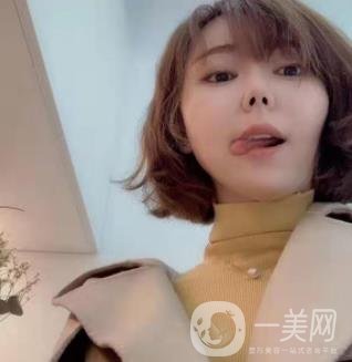 西南醫(yī)院美容整形科打*多少錢？價格表及案例*果