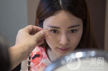 北京處整形外科價(jià)格(目)表2020一覽，附雙眼皮案例