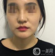 深圳人民醫(yī)院整形外科價(jià)目表，附隆鼻案例