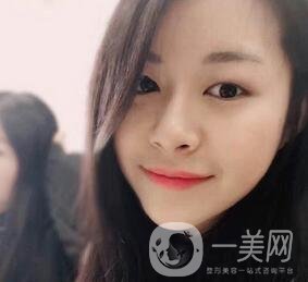 上海華美醫(yī)療美容醫(yī)院價格表，附雙眼皮修復(fù)案例