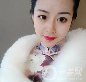 上海華美醫(yī)療美容醫(yī)院價格表，附雙眼皮修復(fù)案例