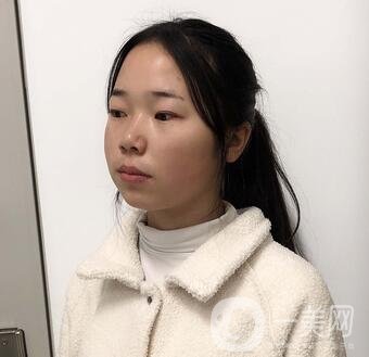 西安高一生醫(yī)療美容醫(yī)院價(jià)格表，附面部吸脂案例分享