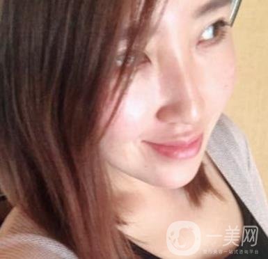 常州美貝爾整形美容醫(yī)院*注射多少錢？價格明細(xì)和*果圖展示