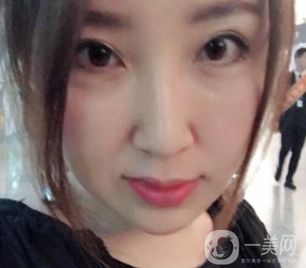 常州美貝爾整形美容醫(yī)院*注射多少錢？價格明細(xì)和*果圖展示