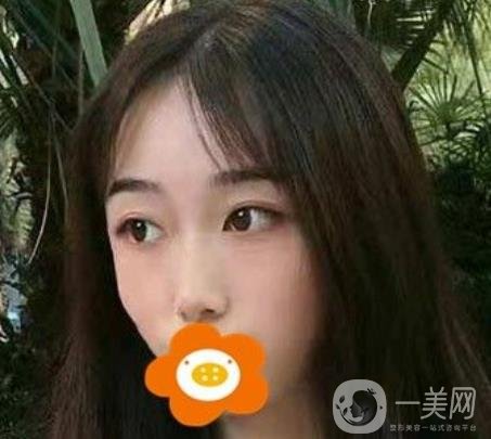 南京美貝爾整形醫(yī)院做*好不好？?jī)r(jià)格表費(fèi)用明細(xì)和*果圖參考