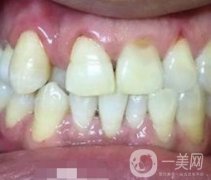 貴州口腔醫(yī)院正畸醫(yī)生信息介紹？?jī)?nèi)含牙齒美容項(xiàng)目?jī)r(jià)格表及案例