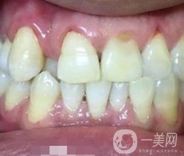 貴州口腔醫(yī)院正畸醫(yī)生信息介紹?內(nèi)含牙齒美容項(xiàng)目價(jià)格表及案例