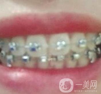 貴州口腔醫(yī)院正畸醫(yī)生信息介紹?內(nèi)含牙齒美容項(xiàng)目價(jià)格表及案例