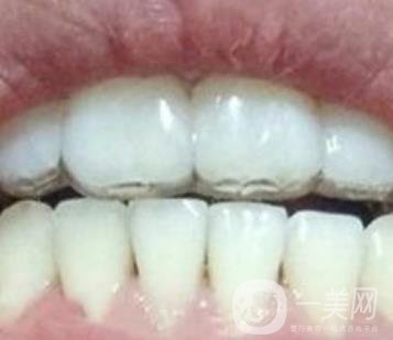 貴州口腔醫(yī)院正畸醫(yī)生信息介紹?內(nèi)含牙齒美容項(xiàng)目價(jià)格表及案例