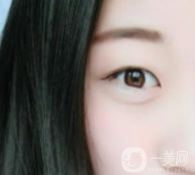 沈陽百嘉麗醫(yī)院價格表2020，附雙眼皮案例分享