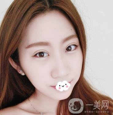沈陽百嘉麗醫(yī)院價格表2020，附雙眼皮案例分享