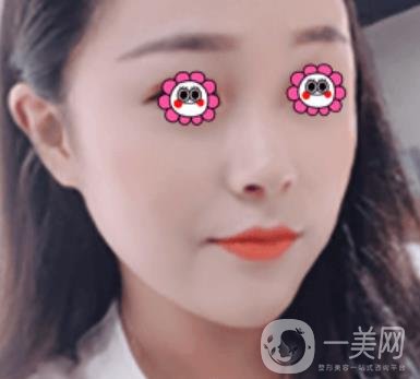 沈陽伊美爾整形醫(yī)院價格表，附祛斑*果展示
