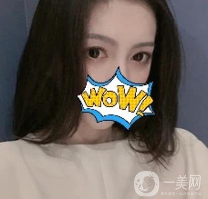 武漢艾萊美醫(yī)療整形醫(yī)院價(jià)格表項(xiàng)目收費(fèi)明細(xì)，附雙眼皮案例
