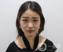 西安華旗唯美整形醫(yī)院做*多少錢？價格表收費明細和案例分享