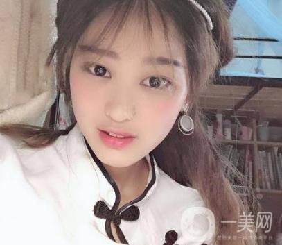 西安華旗唯美整形醫(yī)院做*多少錢(qián)？?jī)r(jià)格表收費(fèi)明細(xì)和案例分享