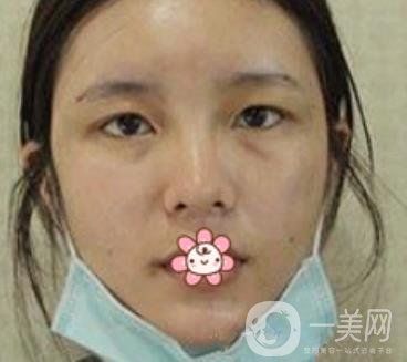襄陽中心醫(yī)院整形美容科價(jià)格表2020版出爐，附雙眼皮日記