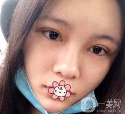 襄陽中心醫(yī)院整形美容科價(jià)格表2020版出爐，附雙眼皮日記