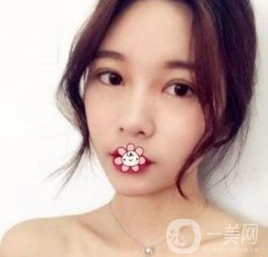 襄陽中心醫(yī)院整形美容科價(jià)格表2020版出爐，附雙眼皮日記