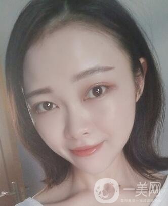 徐州亞韓整形醫(yī)院價格表費用明細，附面部除皺日記展示