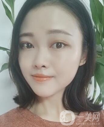徐州亞韓整形醫(yī)院價格表費用明細，附面部除皺日記展示