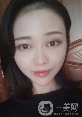 徐州亞韓整形醫(yī)院價格表費用明細，附面部除皺日記展示