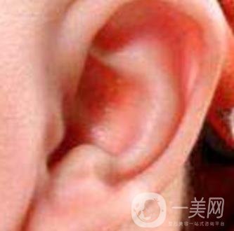 中國醫(yī)學(xué)科學(xué)院整形外科醫(yī)院外耳再造技術(shù)如何?*果好嗎?價格表收費標(biāo)準(zhǔn)一覽