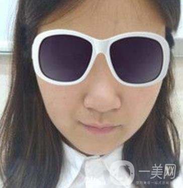 北京亞楠容悅醫(yī)療美容**果靠譜嗎?2020年價格明細(xì)一覽表