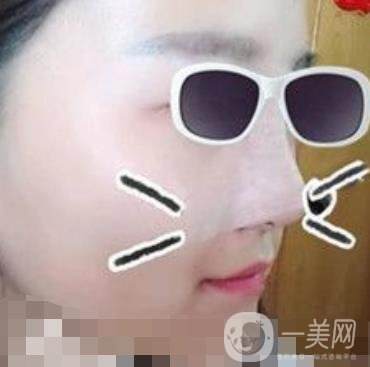 北京亞楠容悅醫(yī)療美容**果靠譜嗎?2020年價格明細(xì)一覽表