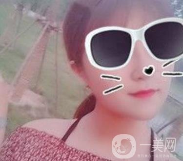 北京亞楠容悅醫(yī)療美容**果靠譜嗎?2020年價格明細(xì)一覽表