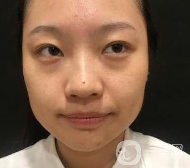 北京知音醫(yī)療美容熱瑪吉*果怎么樣？貴嗎？收費價格表2020公布