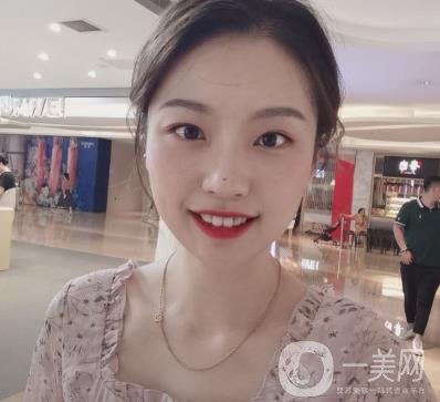 北京知音醫(yī)療美容熱瑪吉*果怎么樣？貴嗎？收費價格表2020公布