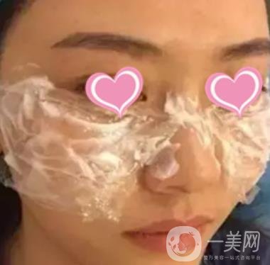 徐州二院激光祛斑怎么樣?案例及2020整形價格表一覽