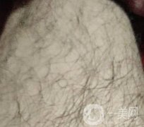 合肥華美整形醫(yī)院價(jià)格表，附脫毛案例