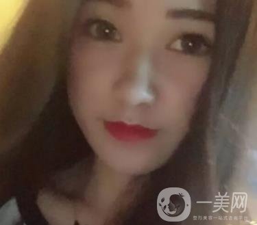 徐州第一人民醫(yī)院整形科價格表，含激光祛疤*果