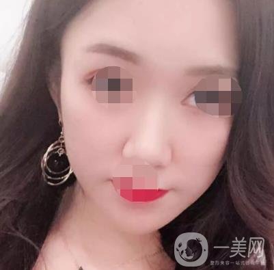 徐州第一人民醫(yī)院整形科價格表，含激光祛疤*果