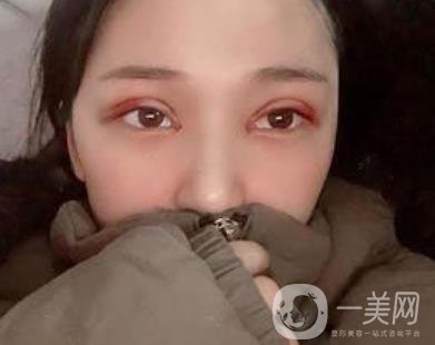 恩施州中心醫(yī)院美容整形科怎么樣？?jī)r(jià)格表和雙眼皮整形經(jīng)歷分享