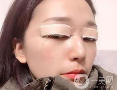 恩施州中心醫(yī)院美容整形科怎么樣？?jī)r(jià)格表和雙眼皮整形經(jīng)歷分享