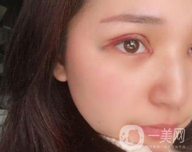 恩施州中心醫(yī)院美容整形科怎么樣？?jī)r(jià)格表和雙眼皮整形經(jīng)歷分享