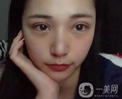 恩施州中心醫(yī)院美容整形科怎么樣？?jī)r(jià)格表和雙眼皮整形經(jīng)歷分享