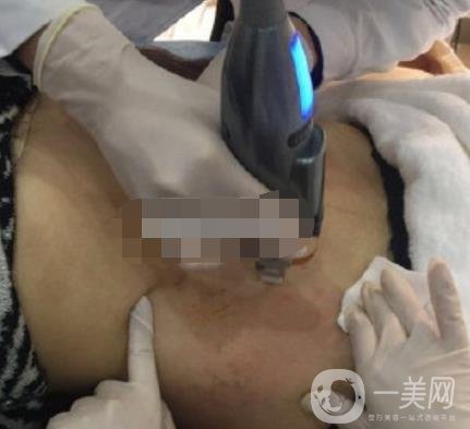 汾陽醫(yī)院美容整形科祛妊娠紋怎么樣？手術(shù)項目收費價格表和案例一覽