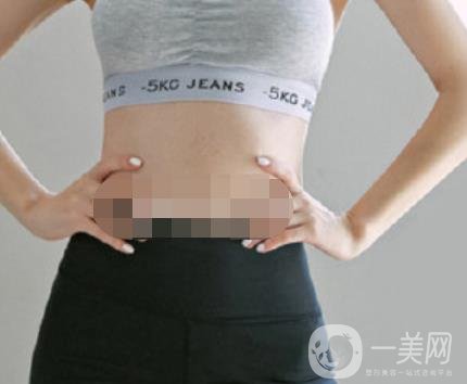 汾陽醫(yī)院美容整形科祛妊娠紋怎么樣？手術(shù)項目收費價格表和案例一覽