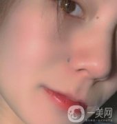 黃岡市中心醫(yī)院美容整形科祛痣多少錢？價格費用表和果圖精選