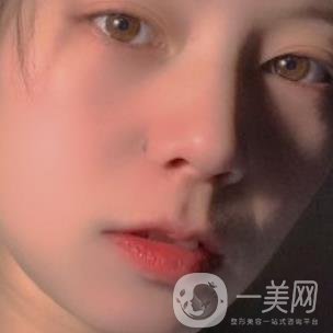 黃岡市中心醫(yī)院美容整形科祛痣多少錢？價格費用表和*果圖精選