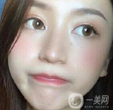 荊州市第三人民醫(yī)院整形美容科*祛斑*果好嗎？收費(fèi)價(jià)格明細(xì)表一覽