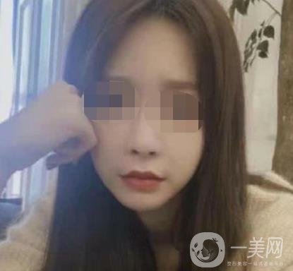 河北省人民醫(yī)院激光祛斑多少錢?附2020整形價格表一覽