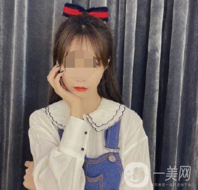 河北省人民醫(yī)院激光祛斑多少錢?附2020整形價格表一覽