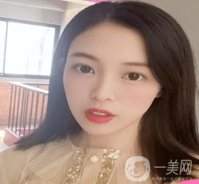 贛州附屬醫(yī)院整形美容科價格表及點痣案例公布，速覽
